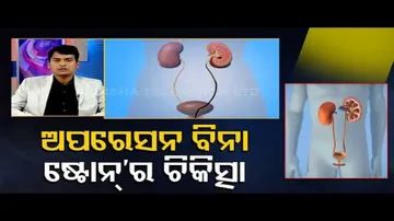 Doctor Doctor | Symptoms & Cure Of Kidney Stones