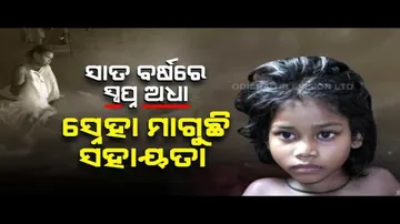 Apana Eka Nuhanti- Deogarh’s minor girl with burn injuries cries for assistance