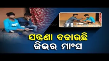 Apana Eka Nuhanty- Youth undergoing unbearable pain for abnormal muscle growth on tongue