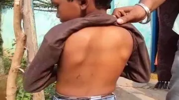 ପୁଣି ମାତିଲେ ପାଗଳା କୁକୁର