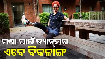 Dancer Lost Both Arms And Legs After Bitten By Mosquito