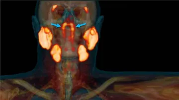 ମଣିଷ ଶରୀରରେ ନୂଆ ଅଙ୍ଗ ଠାବ କଲେ ବୈଜ୍ଞାନିକ