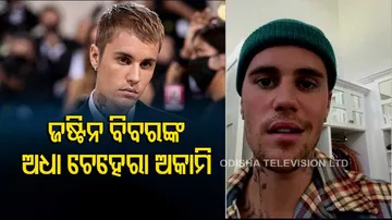 Justin Bieber Says He Has Facial Paralysis