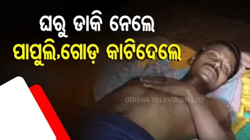 Leg And Palm Of A Migrant Labourer From Gajapati Area Chopped Off 