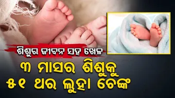 3-Month-Old Baby Poked 51 Times With Hot Rod