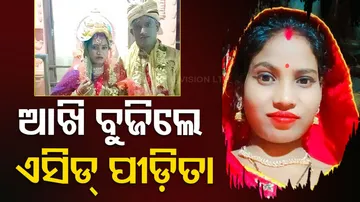 Acid Attack Victim Succumbs To Burn Injuries At SCB