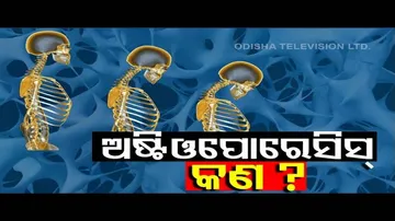 Doctor Doctor | Reasons & Cure Of Osteoporosis