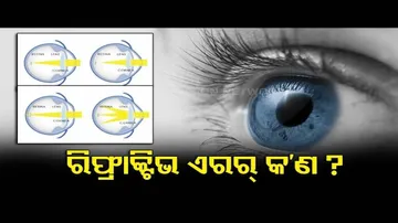 Refractive Error- Causes & Treatment | Doctor Doctor | OTV