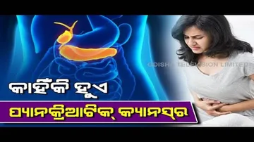 Pancreatic Cancer- Causes, Symptoms & Treatment