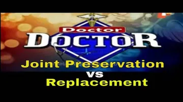 Doctor Doctor 03 Nov 2019 | Joint Preservation vs Replacement | Dr. Sandip Biswal