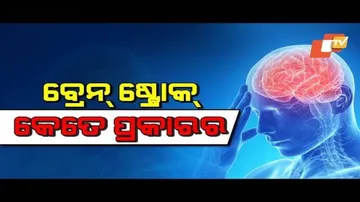 Doctor Doctor- Message On World Stroke Day