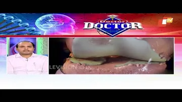 Doctor Doctor 14 Jan 2018 | Arthritis | ଆଣ୍ଠୁ ଗଣ୍ଠି ବାତ | Causes, Symptoms & Traetment