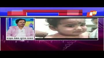 Doctor Doctor | Causes, Symptoms & How To Cure Skin Cirrhosis