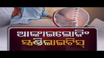 Doctor Doctor 17 July 2022 | Ankylosing Spondylitis - Symptoms and causes | Laparoscopic Surgery |