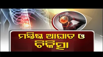 Doctor Doctor | Head Injury – Causes, Symptoms and Home Care