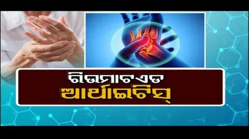 Doctor Doctor | Rheumatoid Arthritis : Causes, Symptoms and Treatments