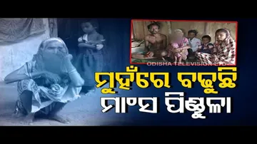 Apana Eka Nuhanti | Poor elderly woman living with huge tumour on face; seeks govt help