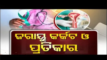 Doctor Doctor | Cervical Cancer and Treatment