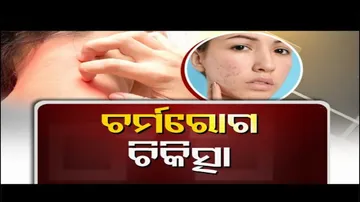 Doctor Doctor | Winter Skin Problems & Best Solutions