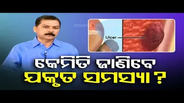 Doctor Dotor | How to take proper care of liver?