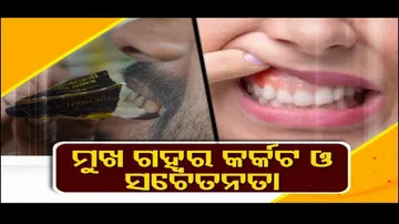 Doctor Doctor | Oral Cancer: Prevention, Early Detection, and Treatment