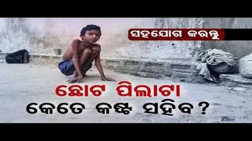 Apana Eka Nuhanti | Parents seek financial assistance to cure son in Sundargarh
