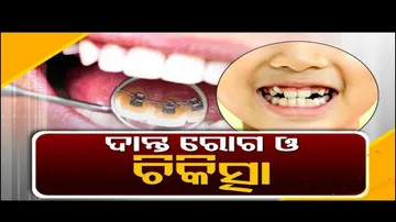 Doctor Doctor | Misaligned Teeth: Causes, Concerns and Cure