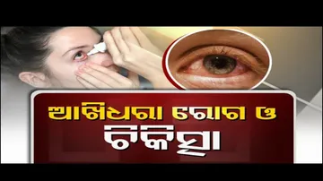 Doctor Doctor | Pink Eye (Conjunctivitis)- Diagnosis and treatment