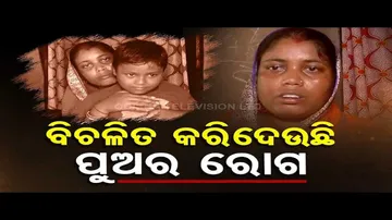 Woman in Kendrapara seeks financial assistance for son’s treatment
