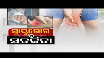 Doctor Doctor |What Is Neuropathy ? Symptoms, Causes, Diagnosis and Precautions