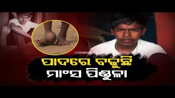 Apana Eka Nuhanti | Koraput woman seeks financial assistance for son’s treatment