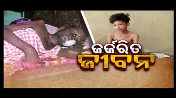 Apana eka nuhanti Ep 701 | 18th Oct 2024 | କିଡନୀ ଖରାପକୁ କ୍ୟାନସର; କେମିତି ବଞ୍ଚିବ ଏ ମଣିଷ ?