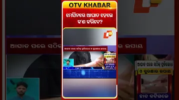 ମେସିନରେ ଆଘାତ ହେଲେ କ’ଣ କରିବେ?#otv #otvnews #odishatv #otvshorts #doctordoctor