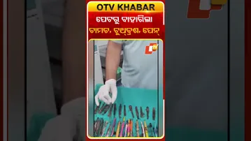 ପେଟରୁ ବାହାରିଲା  ୨୯ ଚାମଚ, ୧୯ ଟୁଥ୍‌ବ୍ରଶ୍‌ କଲମ #OTVshorts