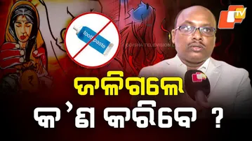 Informative Story : Burn Injury ? Never Use Toothpaste ! What To Do Instead