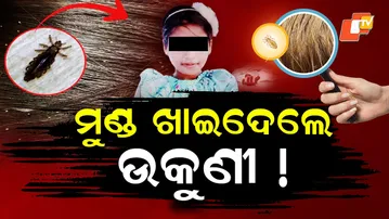 LIVE | ମୁଣ୍ଡରେ ଉକୁଣୀ ହୋଇଥିଲେ ସାବଧାନ | Lice Infection | Breaking News | Odia News | OTV