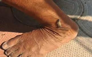 Caterpillar invasion turns life miserable for villagers in Keonjhar