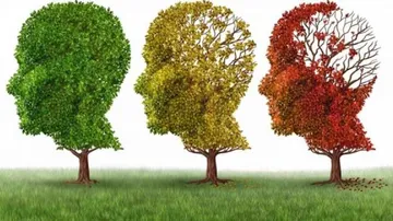 2.5 hours of physical activity per week may prevent Alzheimer's