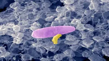 'Predatory bacteria' may help combat antibiotic resistance