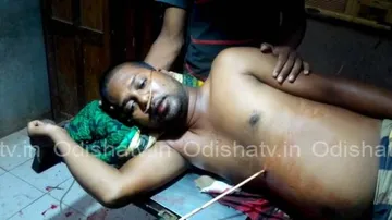 Arrow stuck in body, man rides to hospital in bike for treatment!