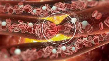 Blood Clotting Significant Cause Of Death In COVID-19 Patients