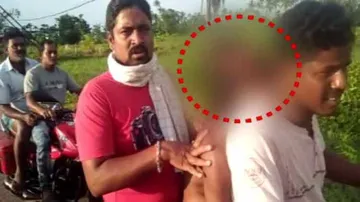 No Ambulance, Family Carries Body On Motorcycle