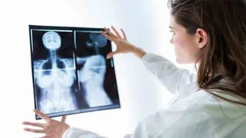 Immunotherapy plus chemo extends life of breast cancer patients