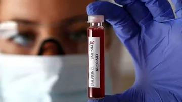 COVID-19: Record 1,761 Deaths In A Day In India