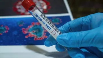 Coronavirus Updates From Around The Globe Today