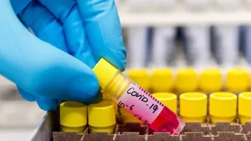 COVID-19: 72,049 New Cases Take India's Corona Tally To 67,57,131