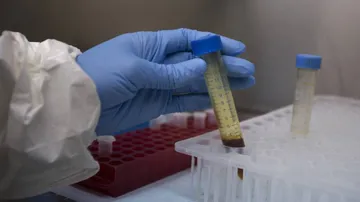 COVID-19 Testing, Treatment Free For Ayushman Bharat Beneficiaries: NHA