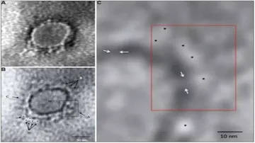 First Images Of COVID-19 Virus Released In India