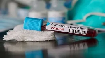 Odisha Reports Highest Single-day Spike Of 304 COVID-19 Cases, Tally Crosses 5000-Mark