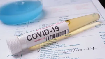 COVID-19 Caseload In India Crosses 75-Lakh Mark
